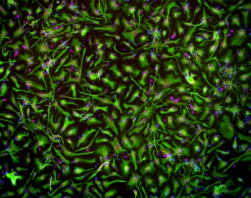 [25sk124] Cortical Astrocytes